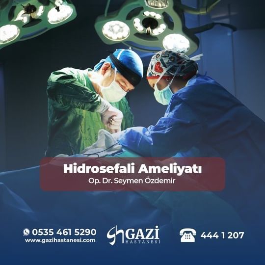 Hidrosefali Ameliyatı Hakkında Bilgilendirme