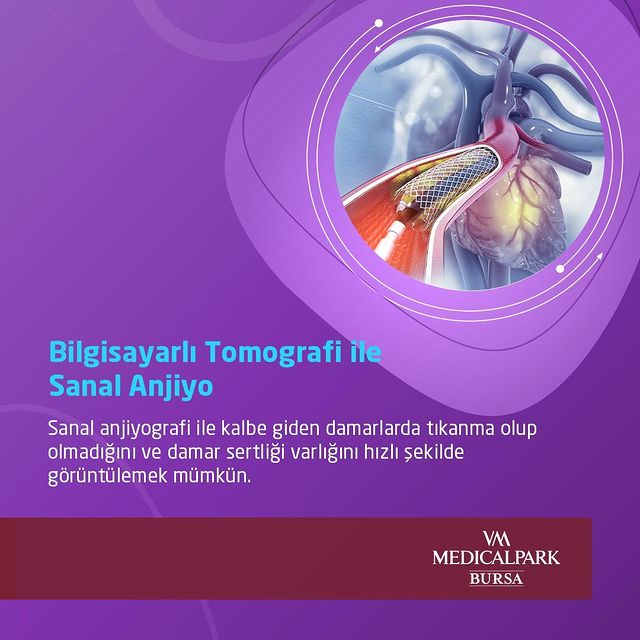 Kalp Sağlığı İçin Bilgisayarlı Tomografi ile Sanal Anjiyo