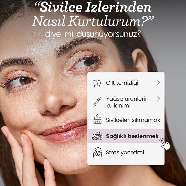 Sivilce İzlerini Azaltmanın Yolları