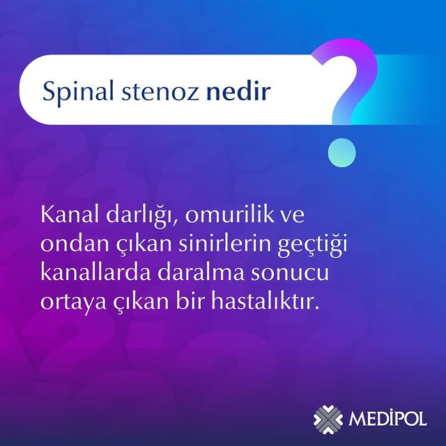 Spinal Stenoz: Kanallarda Daralma Tehlikesi