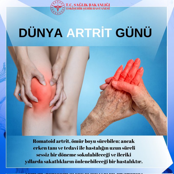 Romatoid Artrit ve Erken Tanı