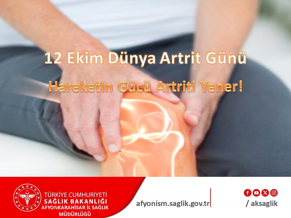 Artrit Hastalığı Hakkında Bilinmesi Gerekenler